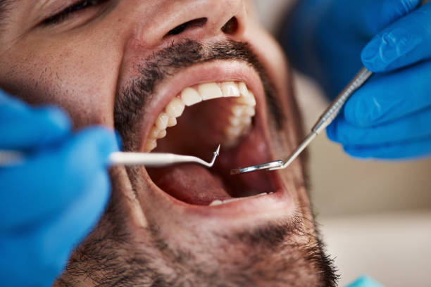 Best After-Hours Dental Care in Mount Ida, AR