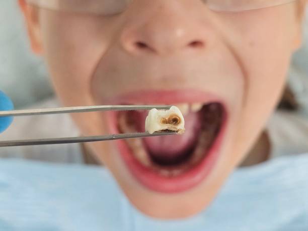 Best Weekend Emergency Dental Services in Mount Ida, AR