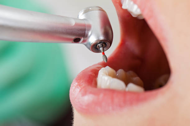 Best Broken or Chipped Tooth Repair in Mount Ida, AR